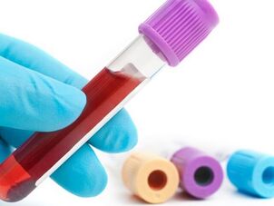Laboratoorsed meetodid